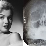 Promi-Röntgenbilder zu verkaufen – heute Marilyn Monroe