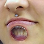 Bodymodification - Extremer Trend: Lippentunnel (+English version)